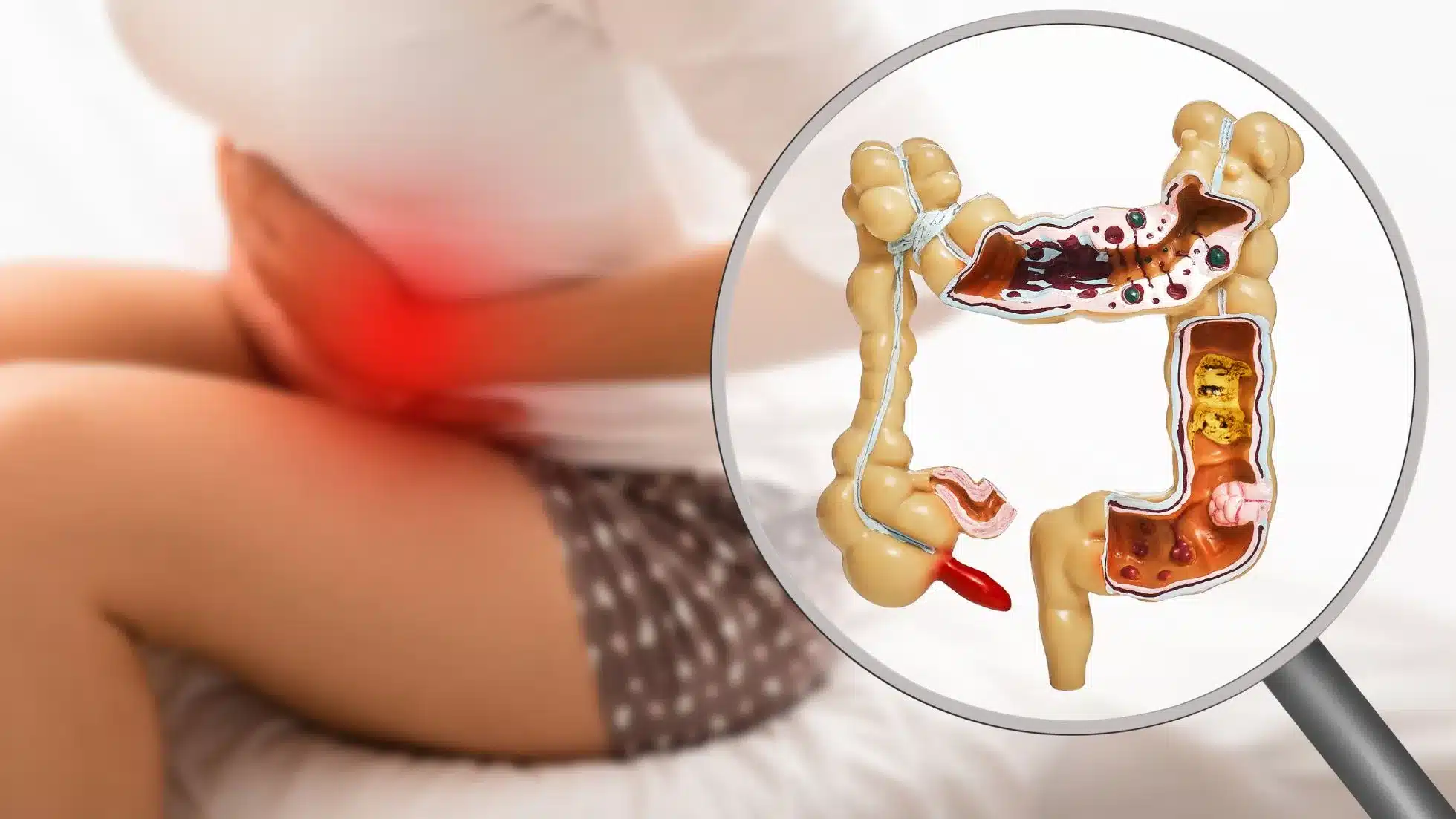 Como Eliminar Gases Intestinais, barriga estufada de gases